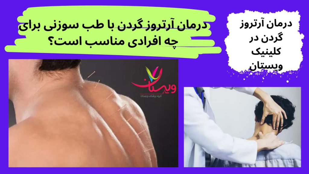 آسیبهای حاد گردن درمان آرتروز گردن با طب سوزنی برای چه افرادی مناسب است