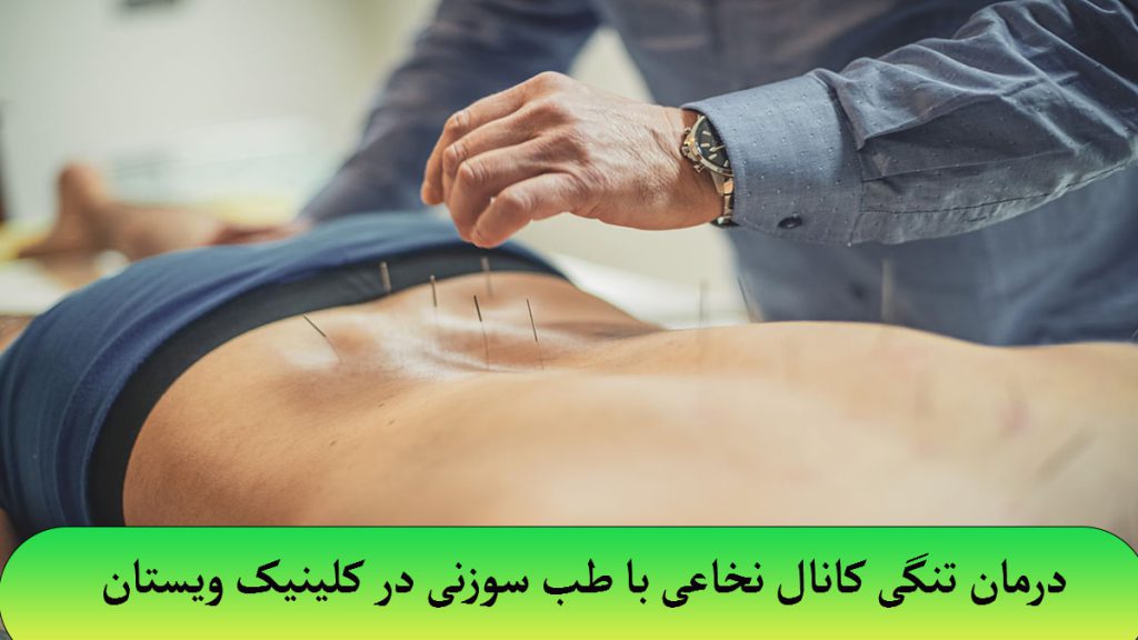 یک پزشک در حال انجام طب سوزنی