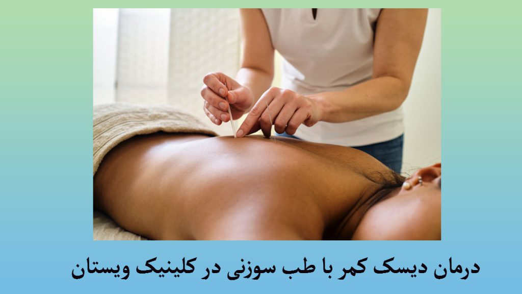 یک پزشک طب سوزنی در حال درمان کمر درد فرد بیمار-نوشته:طب سوزنی برای دیسک کمر