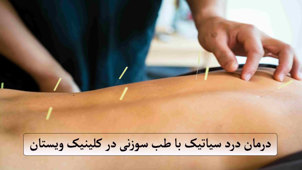 پزشک طب سوزنی در حال درمان درد سیاتیک بیمار 