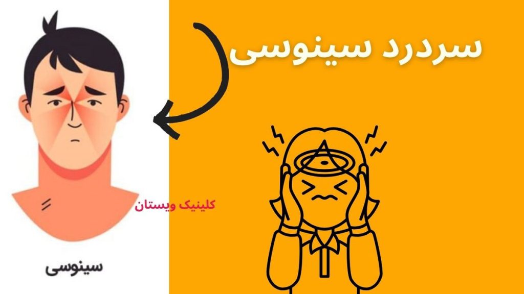 آبریزش بینی