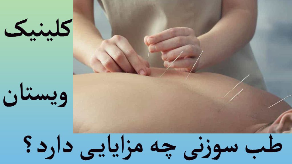 در پس زمینه آبی یک تصویر از پزشکی در حال انجام طب سوزنی