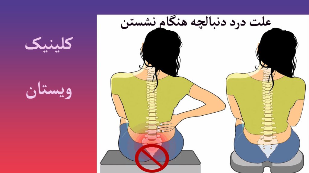 دو خانم در یک تصویر که یکی درد در قسمت کمر و دنبالچه دارد