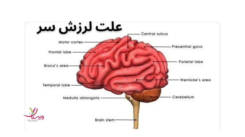 لرزش سر نشانه چیست؟