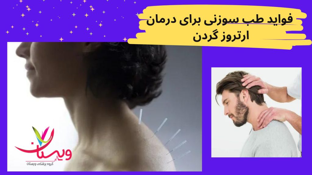 بهبود انعطافپذیری گردن فواید طب سوزنی برای درمان آرتروز گردن