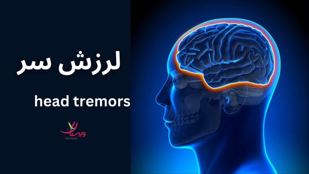 لرزش سر