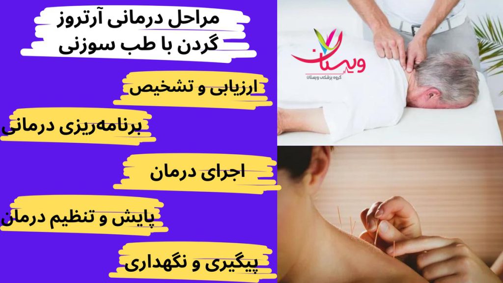 نقاط اطراف گردن مراحل درمانی آرتروز گردن با طب سوزنی