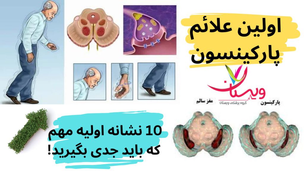اولین علائم پارکینسون