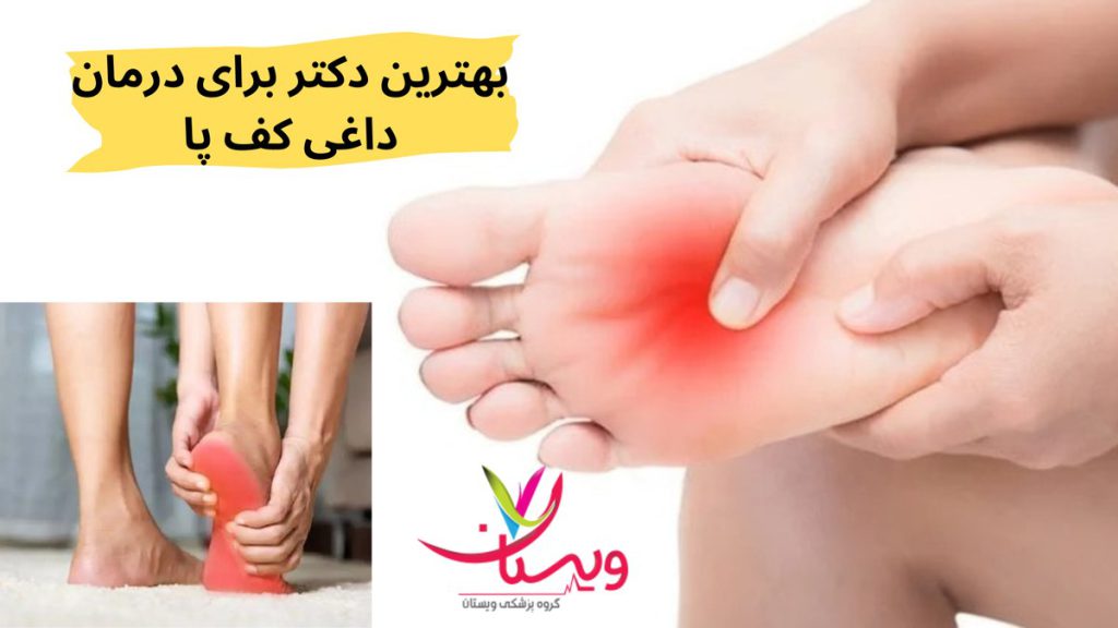 درمان فوری داغی کف پا