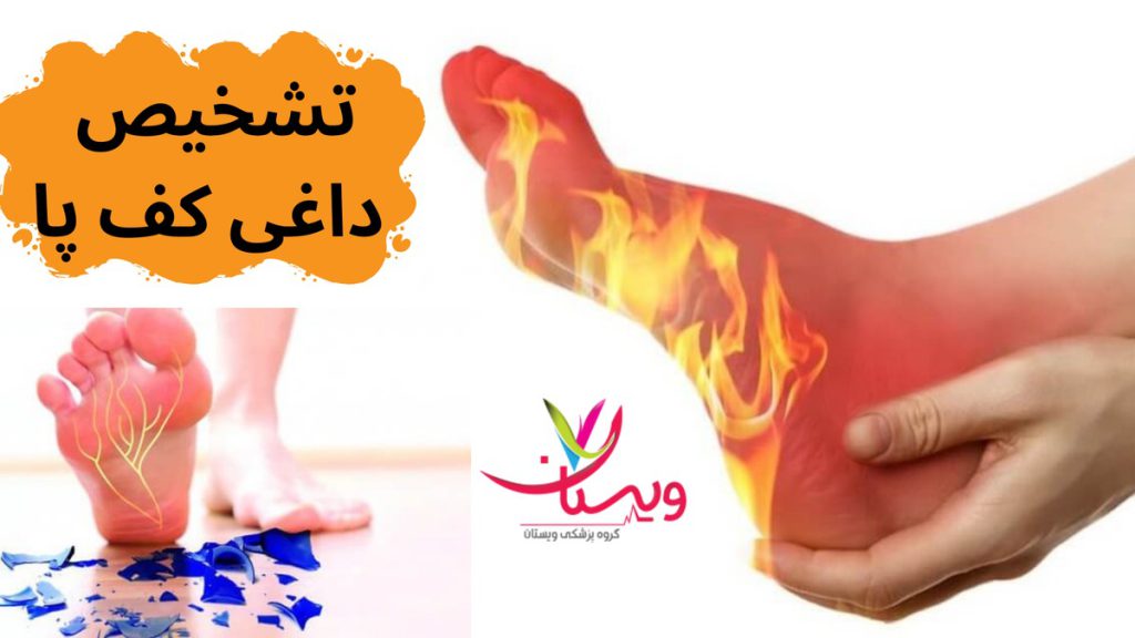 درمان فوری داغی کف پا در خانه