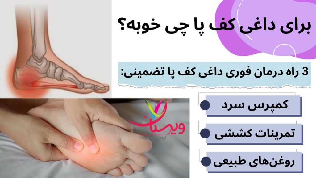 درمان فوری داغی کف پا