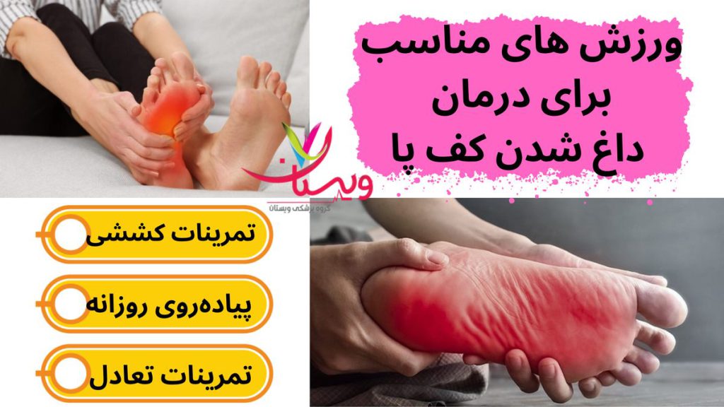 ورزش های مناسب برای درمان داغ شدن کف پا