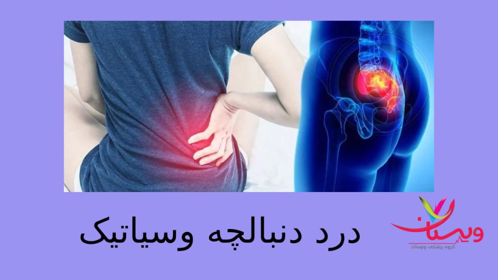 coccyx pain درد دنبالچه و سیاتیک ✚ علت درد دنبالچه هنگام نشستن چیست؟
