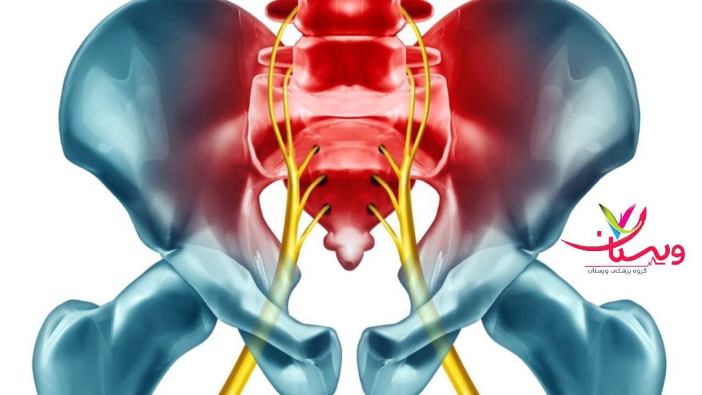 علت آسیب های دنبالچه ساختمان لگن ودنبالچه نشان داده شده است