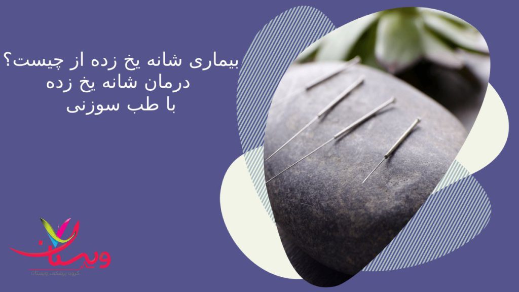 frozen shoulder بیماری شانه یخ زده از چیست؟درمان شانه یخ زده با طب سوزنی1403