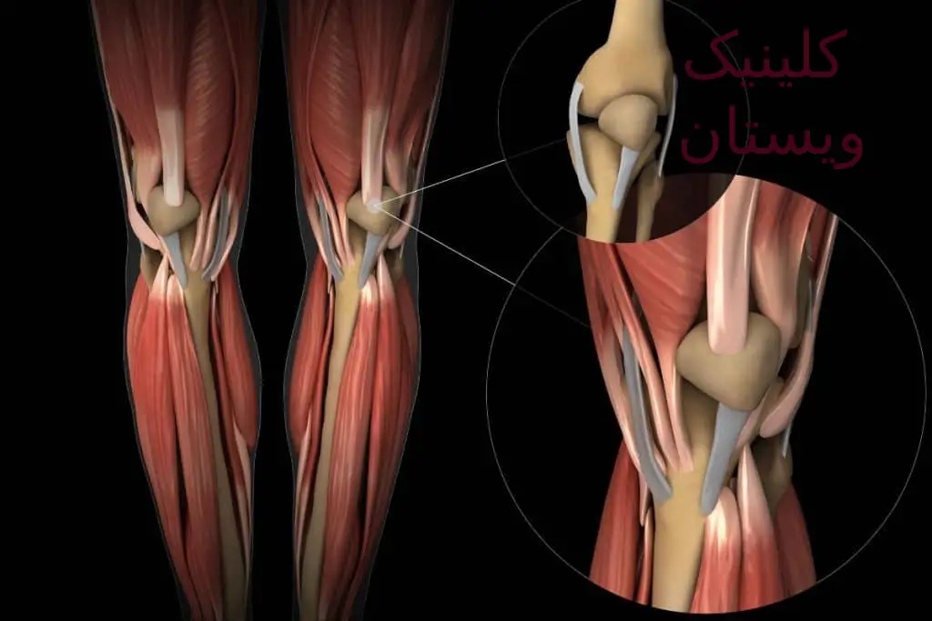 عضلات غیرارادی، مانند عضلات معده و رودهها، به طور خودکار و بدون نیاز به اراده فرد فعالیت میکنند. نوارعصب و عضله (EMG/NCV) کجا بگیرم؟