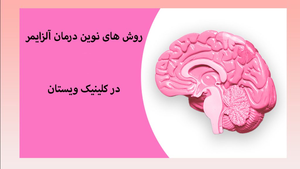 درمان آلزایمر تصویری از یک مولاژ مغز