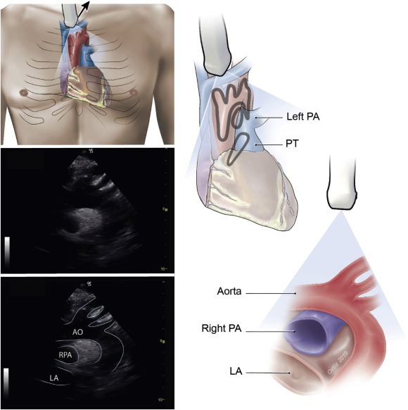 یکی از مزایای سونوگرافی این است که بدون استفاده از اشعه انجام می‌شود و برای بیماران بی‌خطر است.