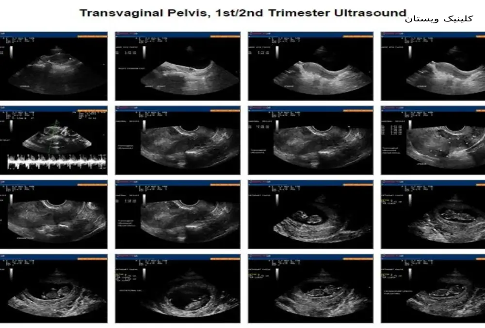 وقت رادیولوژی و سونوگرافی مرزداران