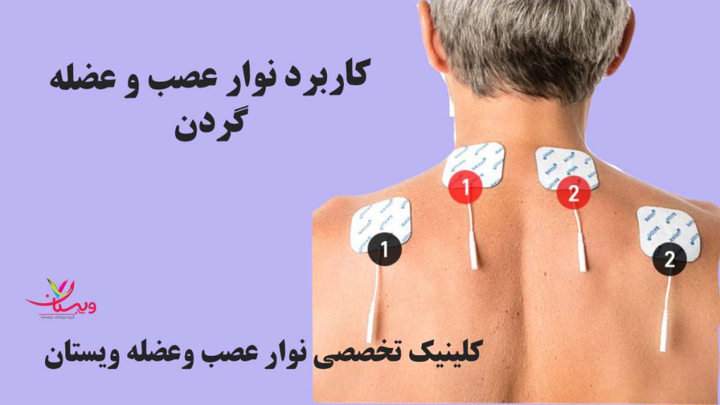 کاربرد نوار عصب وعضله گردن