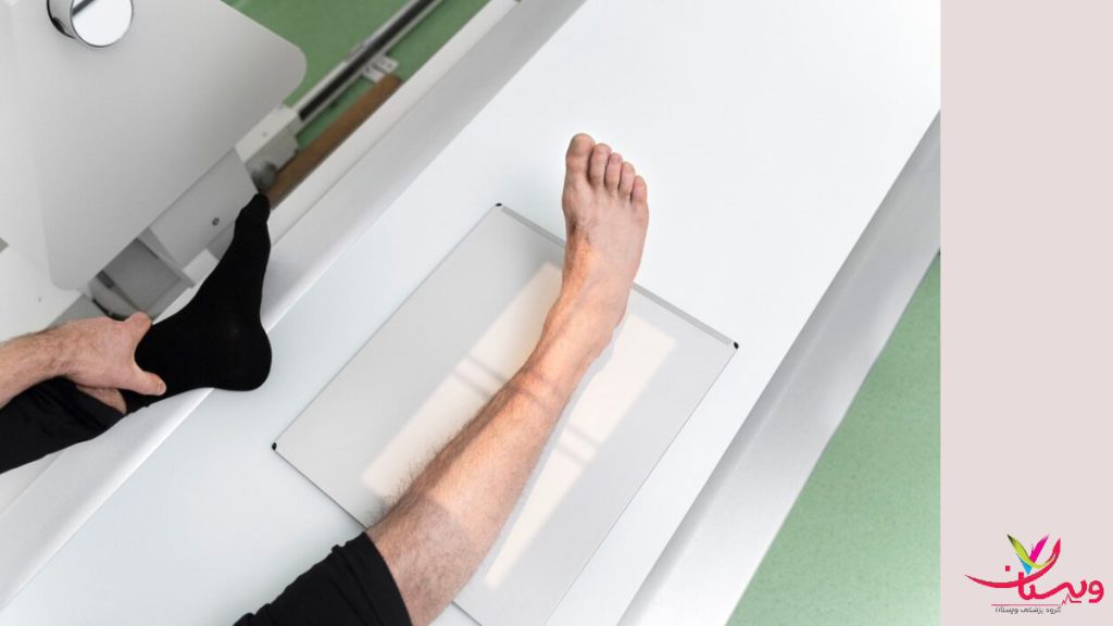 هزینه آزمایش تراکم استخوان1403| "رایگان" با بیمه تکمیلی