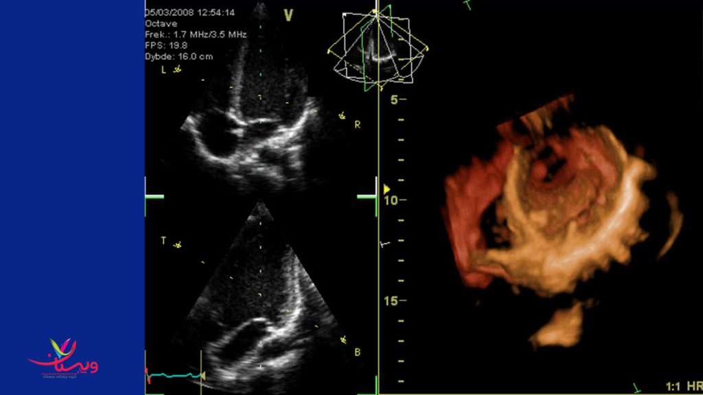 مراکز اکو کاردیو گرافی شبانه روزی مرکز اکو قلب شبانه روزی