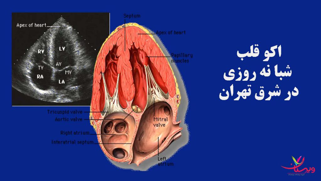 اکو قلب 24 ساعته در شرق و جنوب تهران اکو قلب شبانه روزی در شزق تهران