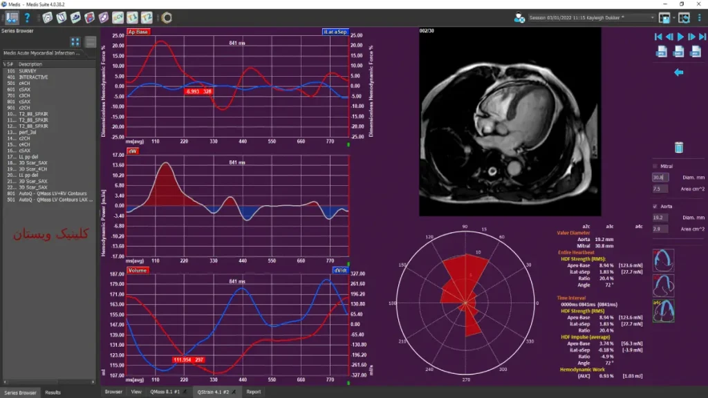 تصویربرداری پزشکی به مجموعه‌ای از روش‌ها اطلاق می‌شود که برای مشاهده و ارزیابی ساختارهای داخلی بدن استفاده می‌شود.