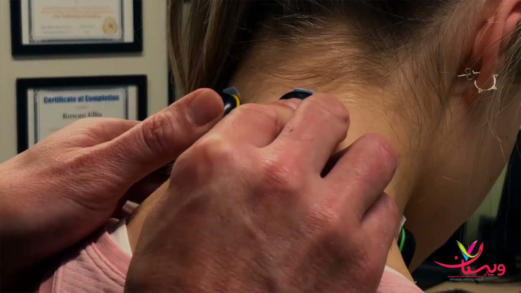 علائم اسیب های عصبی علائم آسیب عصبی گردن