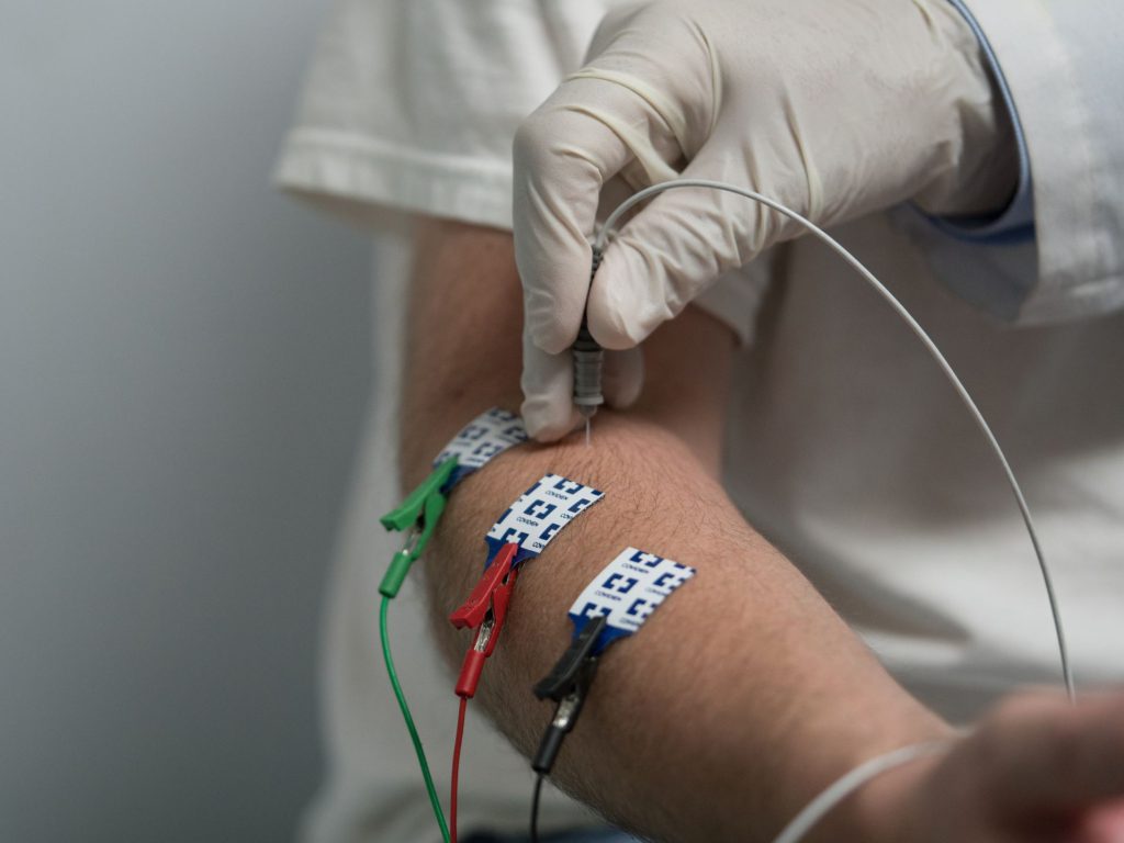 بیماری که نوار عصب وعضله دست خود را چک می کند نوار عصب وعضله دست چپ