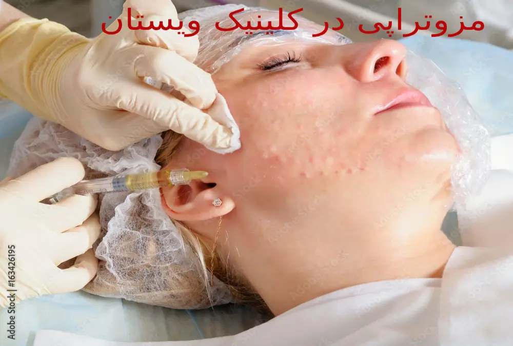 خدمات مزوتراپی لاغری در کلینیک ویستان برای تناسب اندام شما آماده است. مزوتراپی لاغری کی انجام داده