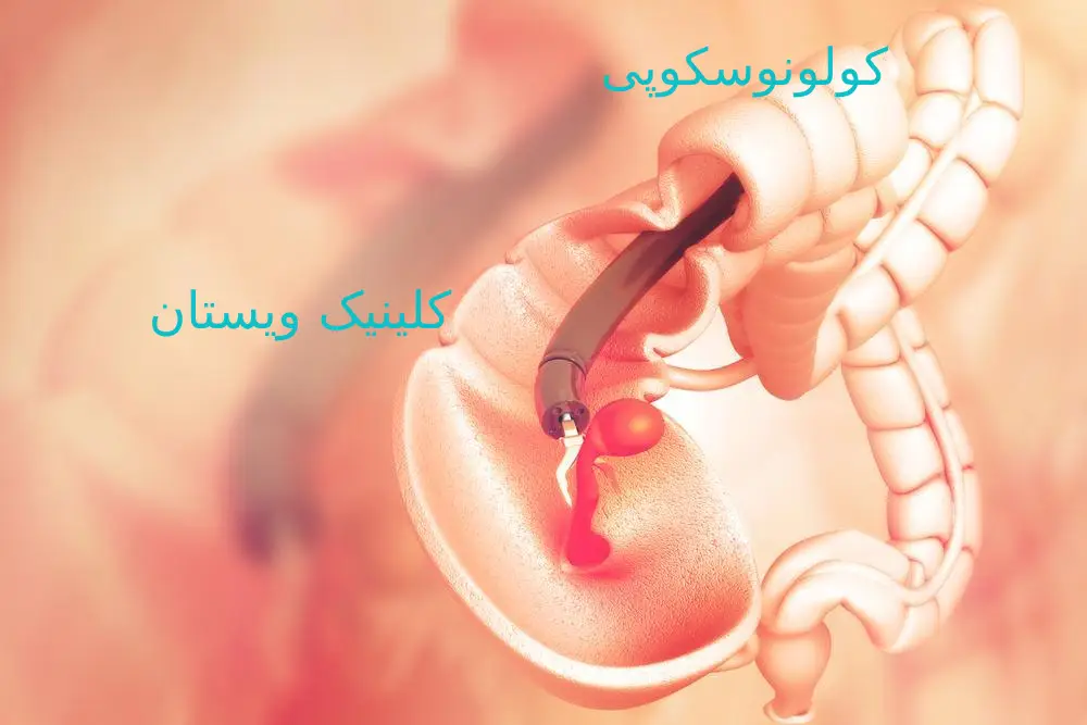 کولونوسکوپی معمولاً با استفاده از آرامبخش یا بیهوشی کوتاه انجام میشود. قبل از انجام کولونوسکوپی، مشاوره تخصصی برای توضیح روند و آمادگی لازم ارائه میشود.