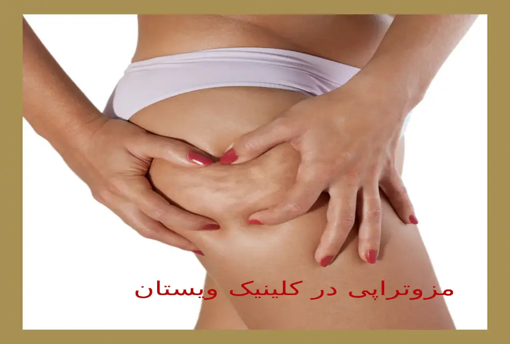 در کلینیک ویستان، لاغری با مزوتراپی به روشی طبیعی و سریع انجام میشود. زیبایی اندام خود را با مزوتراپی لاغری در کلینیک ویستان کامل کنید.