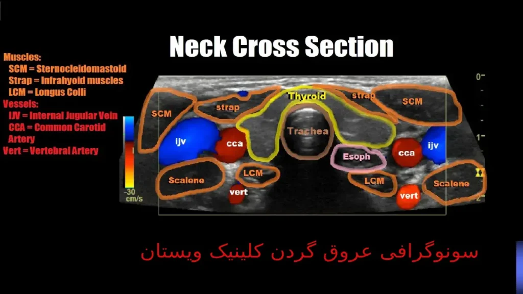 کلینیک ویستان در همکاری با بیمههای معتبر هزینههای شما را مدیریت میکند. تیم متخصص کلینیک ویستان خدمات سونوگرافی عروق گردن را با بالاترین دقت ارائه میدهد.