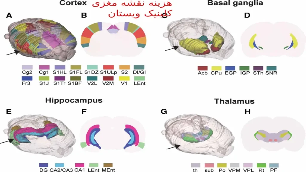 هزینه نقشه مغزی 1403