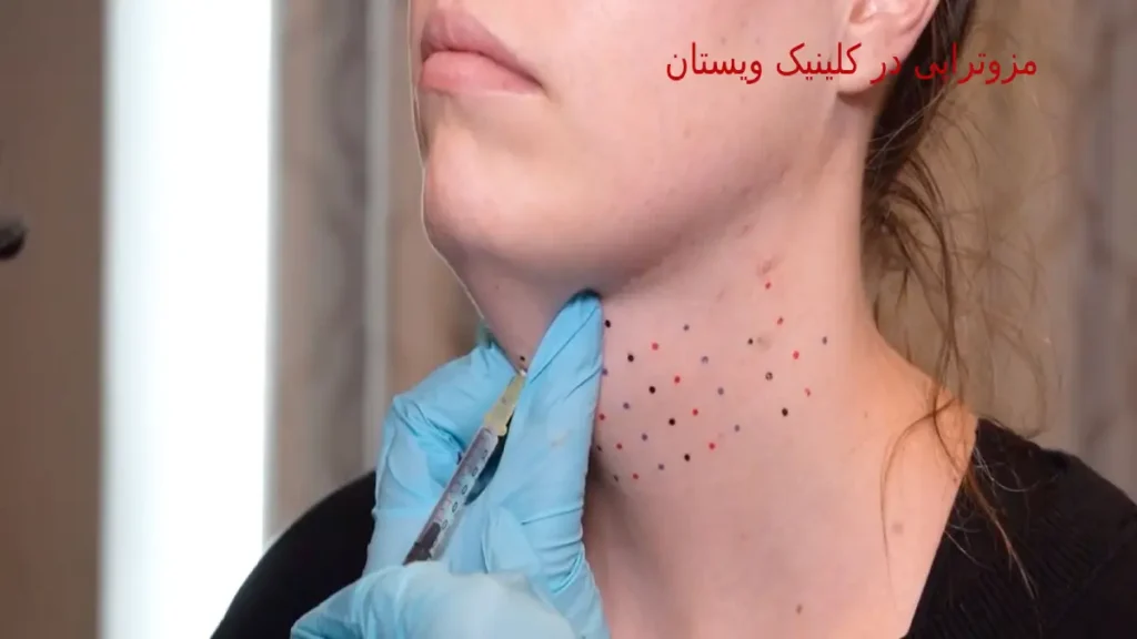 افراد پس از انجام مزوتراپی میتوانند به فعالیتهای روزمره خود بازگردند. مزوتراپی به حل کردن چربیهای انباشته شده در نواحی خاص بدن کمک میکند.