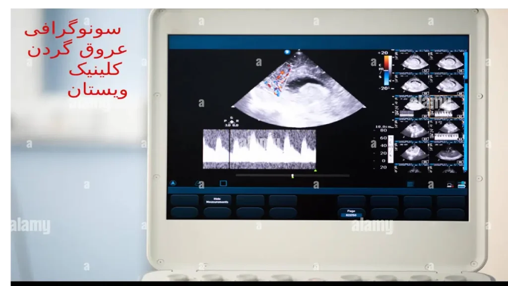 سونوگرافی عروق گردن در کلینیک ویستان با تجهیزات پیشرفته قابل انجام است. کلینیک ویستان محیطی آرام و مدرن برای ارائه خدمات پزشکی فراهم کرده است.