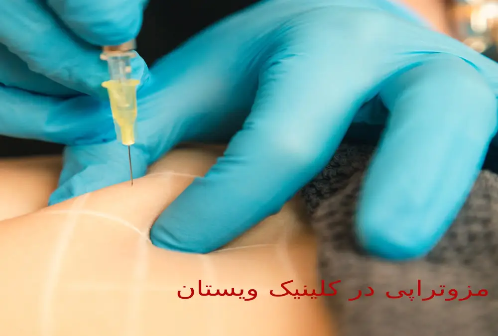 حذف چربیهای سرسخت با خدمات مزوتراپی لاغری در کلینیک ویستان. در کلینیک ویستان، لاغری آسان و سریع با مزوتراپی تضمین میشود.