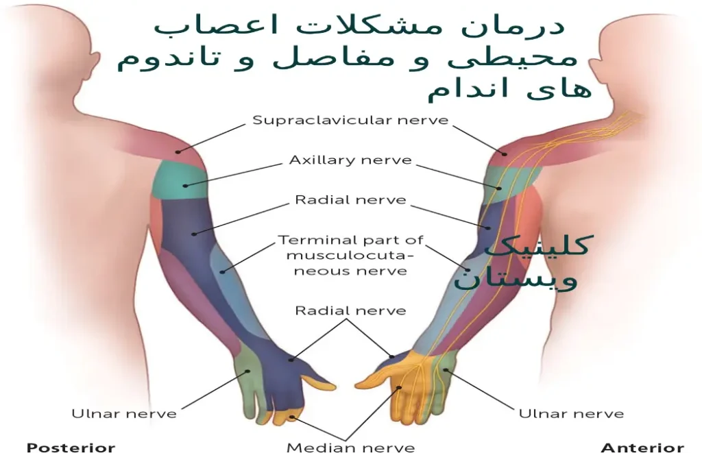 درمان مشکلات اعصاب محیطی مفاصل و تاندونهای اندام