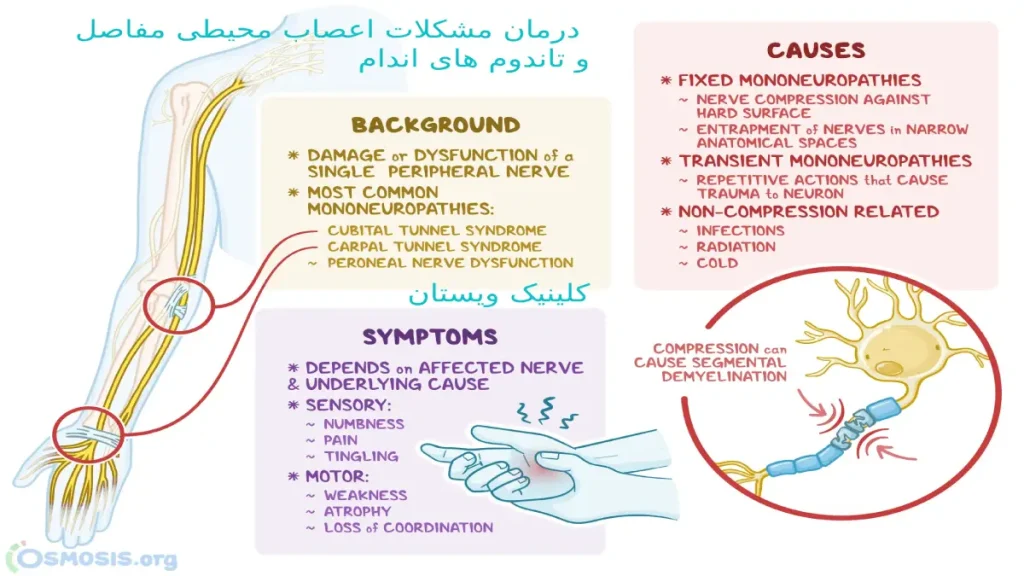 درمان مشکلات اعصاب محیطی مفاصل و تاندونهای اندام