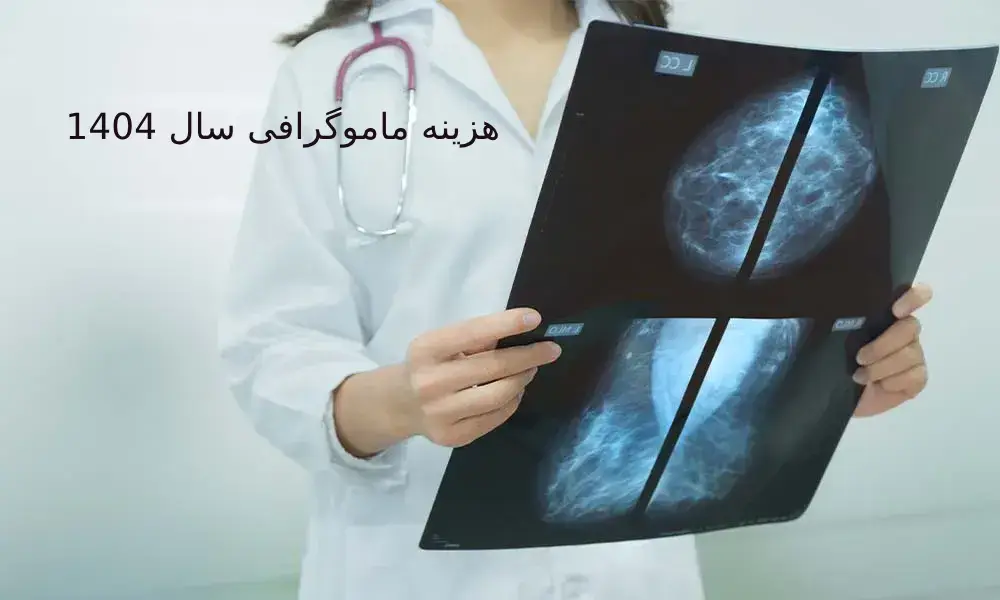 تصویربرداری معمولاً در عرض چند دقیقه انجام میشود. ماموگرافی غربالگری برای شناسایی سرطان در مراحل اولیه انجام میشود.