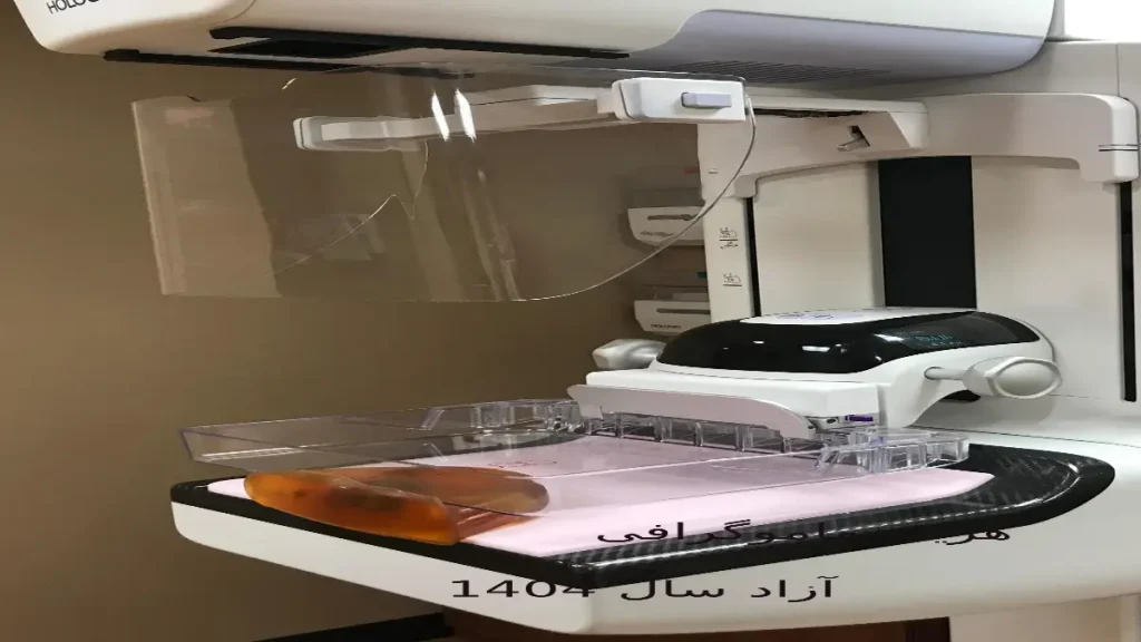ماموگرافی تشخیصی برای بررسی دقیقتر تودههای مشکوک به کار میرود. هزینه ماموگرافی آزاد 1404 پستان