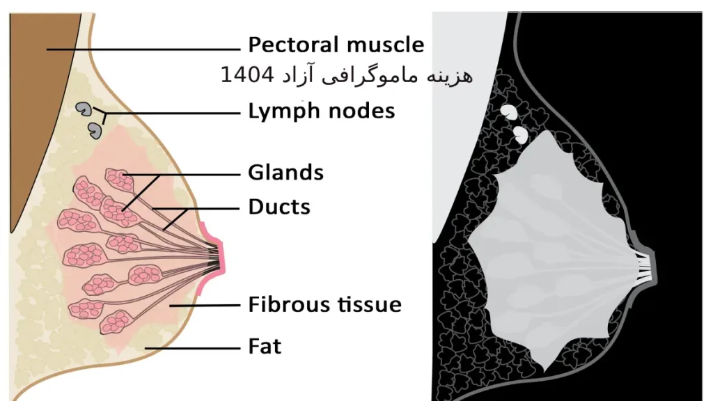 گاهی اوقات نیاز به تکرار ماموگرافی برای وضوح بیشتر تصاویر وجود دارد. وجود کلسیفیکاسیون در ماموگرافی همیشه نشانه سرطان نیست.