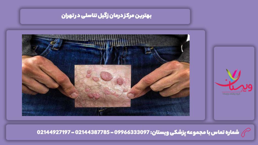 بهترین مرکز درمان زگیل تناسلی