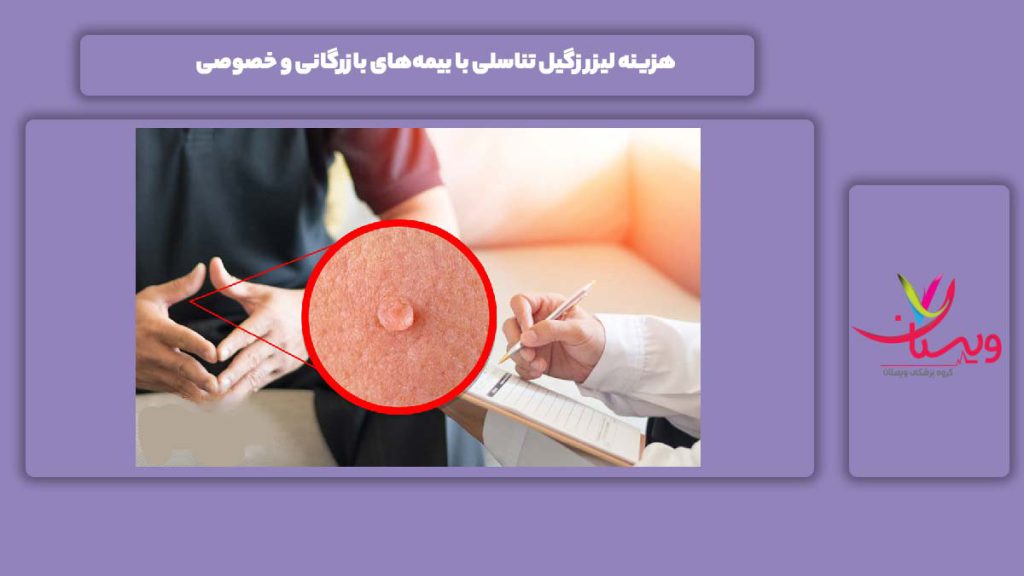 هزینه لیزر زگیل تناسلی با بیمه‌های بازرگانی و خصوصی