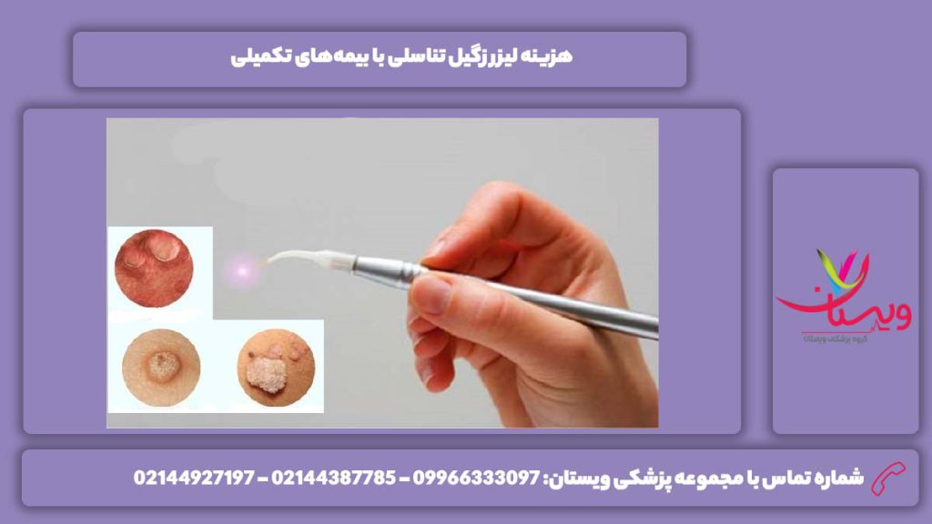 هزینه لیزر زگیل تناسلی با بیمه‌های تکمیلی