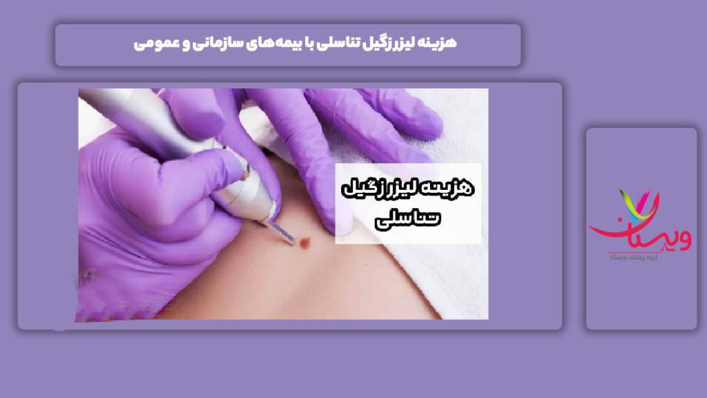 هزینه لیزر زگیل تناسلی با بیمه‌های سازمانی و عمومی