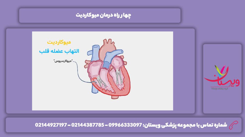 4 راه‌ درمان میوکاردیت