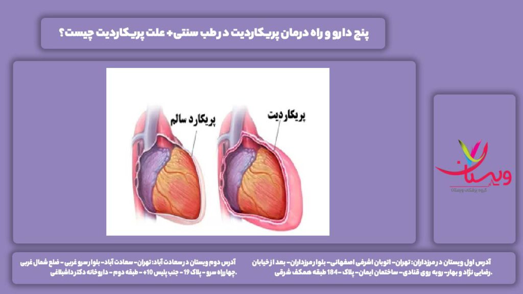 درمان پریکاردیت