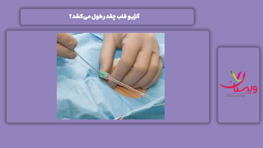 آنژیو قلب چقدر طول می‌کشد؟